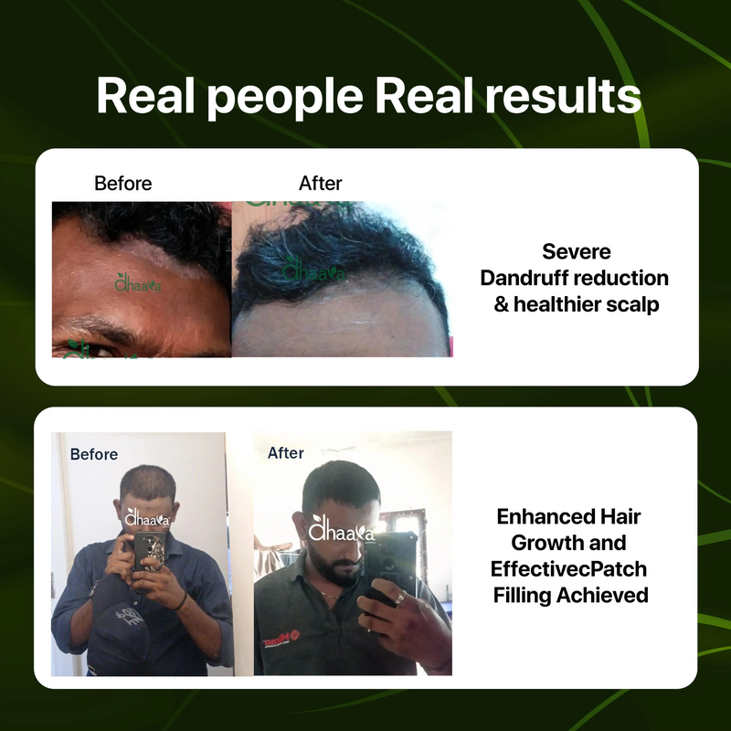 Hair Oil